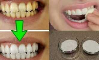 Чем можно отбелить зубы в домашних условиях