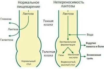 Схема непереносимости лактозы